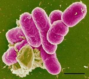 Shigella flexnarii