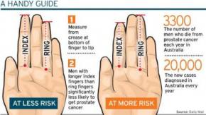 digit-ratio-finger-length-prostate-cancer-2