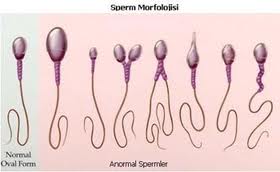 sperm-morfolojisi-morfoloji-anotomi