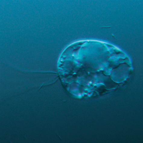 120429_tch_collodictyon-protist-organism.grid-6x2