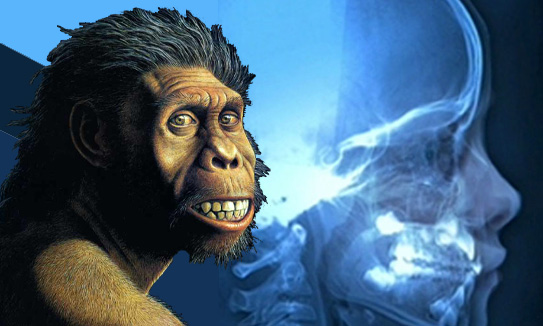 The Robust Australopithecines
